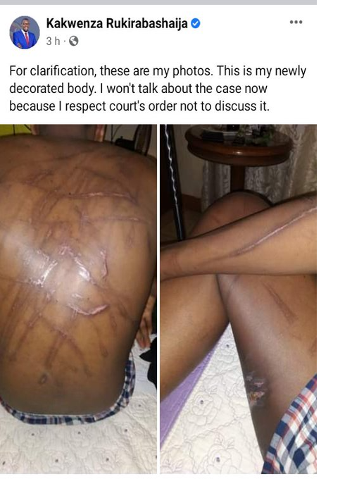 Rukiribashaija tortured photos